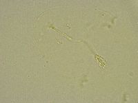 Pilatobius bullatus image