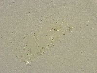 Pilatobius bullatus image