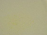 Pilatobius bullatus image