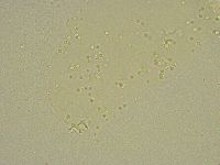Pilatobius bullatus image
