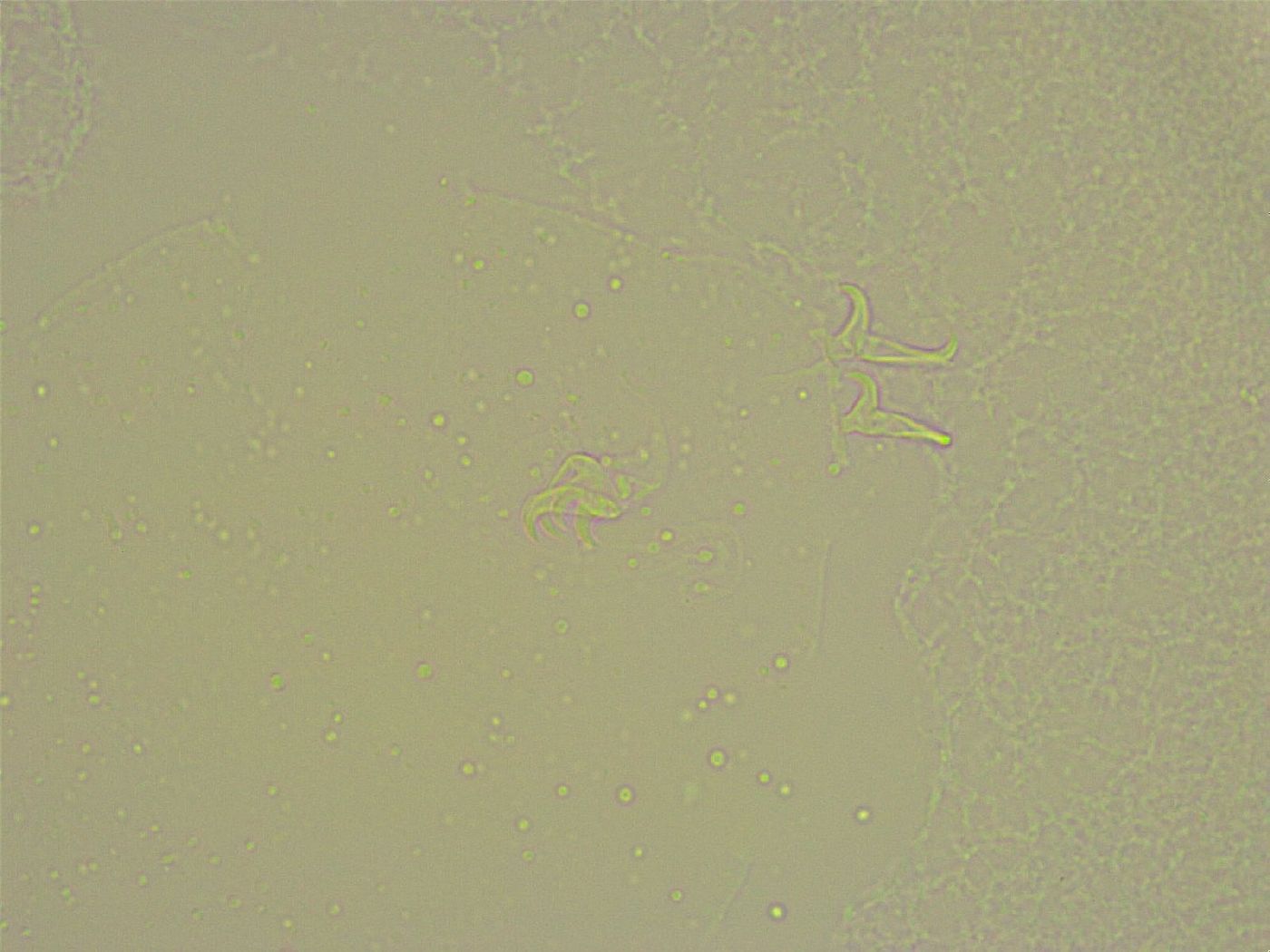 Pilatobius bullatus image