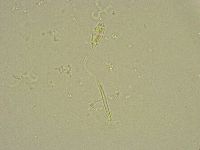 Pilatobius bullatus image