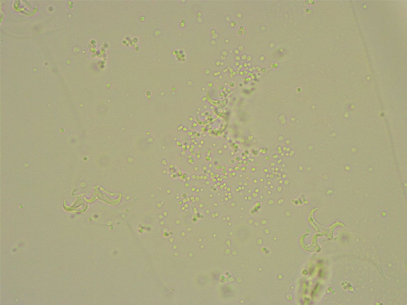 Pilatobius bullatus image