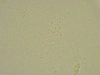 Pilatobius bullatus image