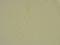 Pilatobius bullatus image