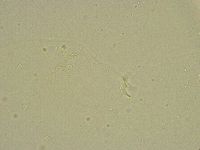 Pilatobius bullatus image