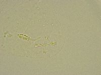 Pilatobius bullatus image