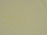 Pilatobius bullatus image