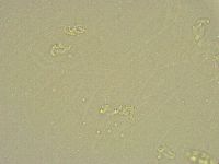 Pilatobius bullatus image