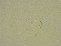 Diphascon chilenense image