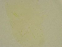 Diphascon chilenense image