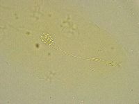 Diphascon chilenense image