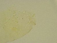 Diphascon chilenense image
