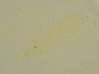 Diphascon chilenense image