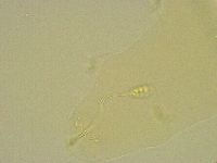 Diphascon chilenense image