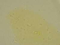 Diphascon chilenense image