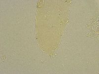 Diphascon chilenense image