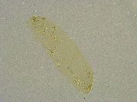 Diphascon chilenense image