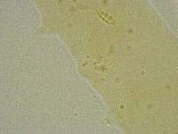 Diphascon chilenense image