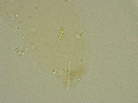 Diphascon chilenense image