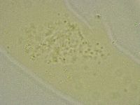 Diphascon chilenense image