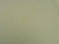 Diphascon chilenense image
