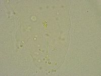 Hebesuncus conjungens image