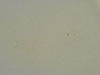Hebesuncus conjungens image