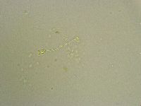 Hebesuncus conjungens image