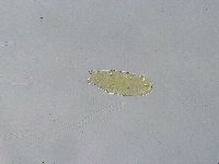 Ramazzottius oberhaeuseri image