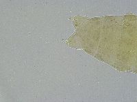 Ramazzottius oberhaeuseri image