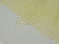 Ramazzottius oberhaeuseri image