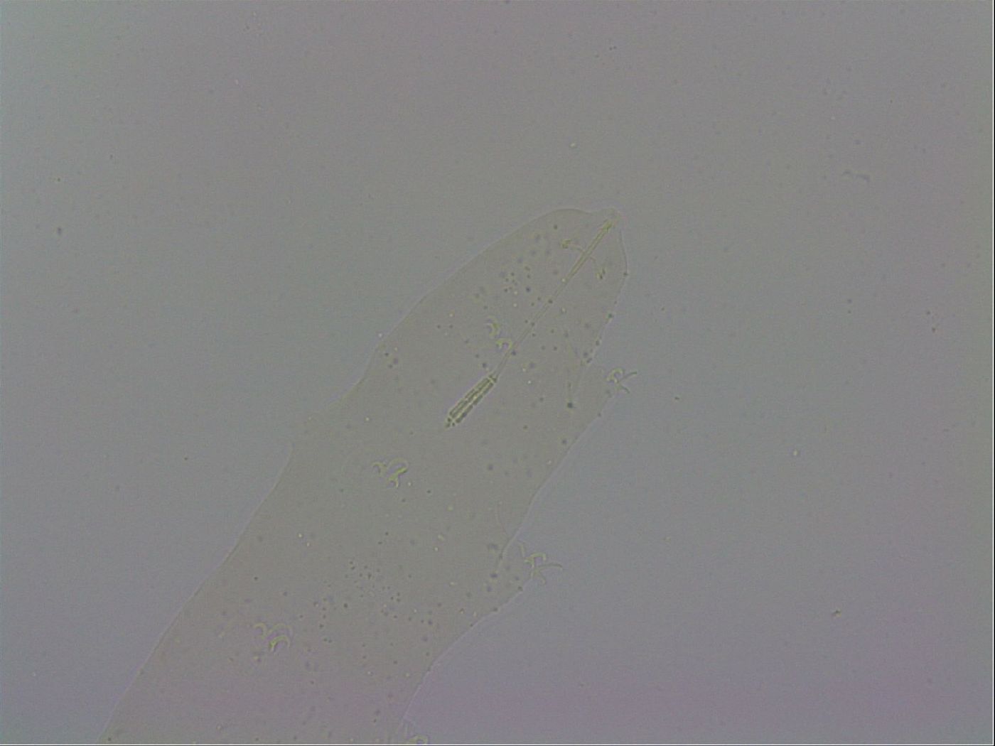 Isohypsibius costatus image