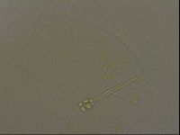 Ramazzottius oberhaeuseri image