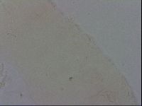 Isohypsibius sattleri image