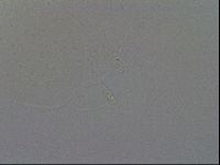 Ramazzottius oberhaeuseri image