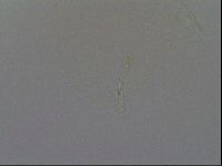 Ramazzottius oberhaeuseri image
