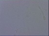 Ramazzottius oberhaeuseri image