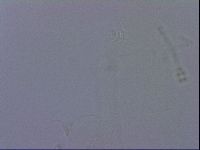 Ramazzottius oberhaeuseri image
