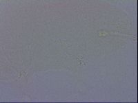 Ramazzottius oberhaeuseri image