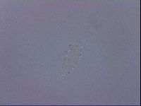 Ramazzottius oberhaeuseri image