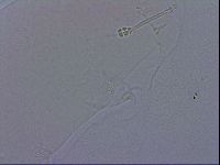 Ramazzottius oberhaeuseri image