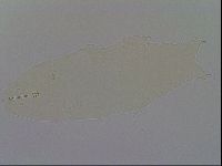 Ramazzottius oberhaeuseri image