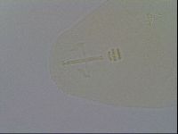 Platicrista angustata image