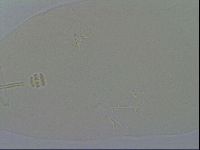 Platicrista angustata image