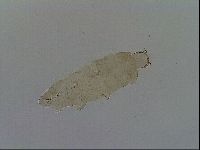 Platicrista angustata image