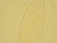Pilatobius oculatus image