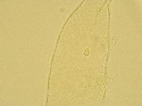 Pilatobius oculatus image