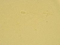 Pilatobius oculatus image