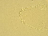 Pilatobius oculatus image